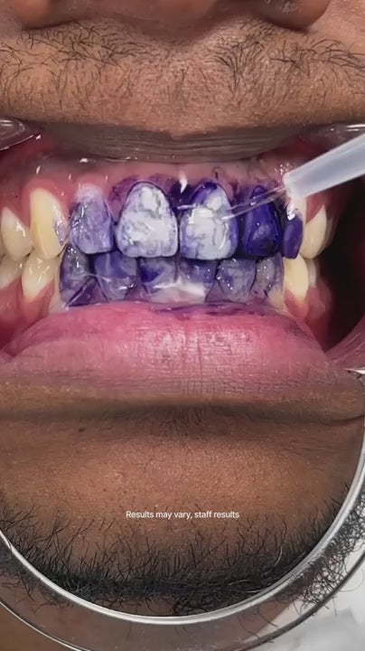 Hismile Teeth Brightening Serum (Original)